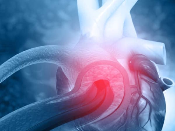 Cardiólogo en La Roma