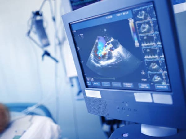 Ecocardiograma